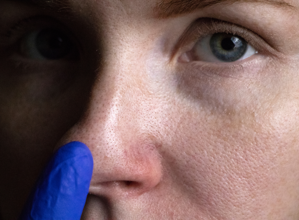 gözenek, cilt, sağlık, kadın, erkek, tedavi, ten