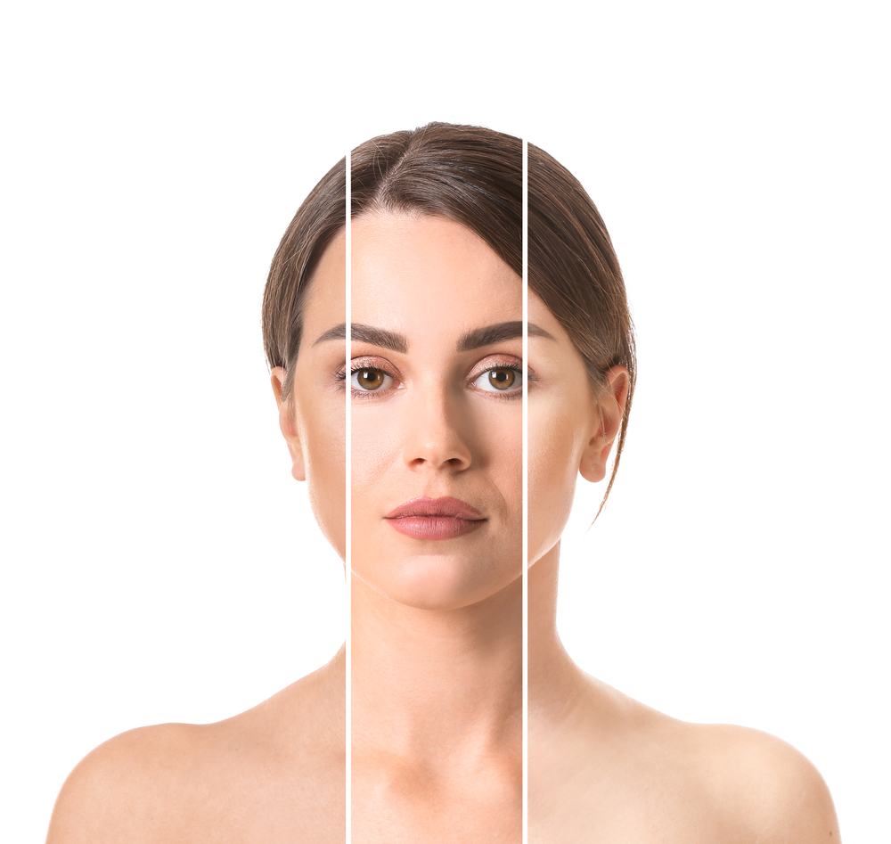 cilt, ton, renk, kişisel bakım, makyaj, kadın