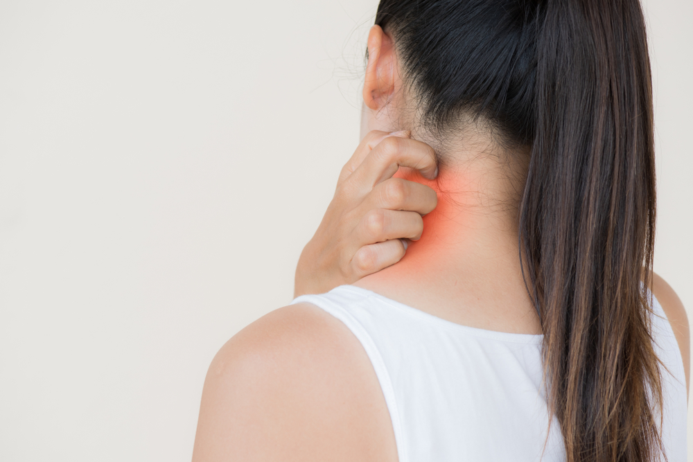 Saçkıran, saç, sağlık, hastalık, cilt