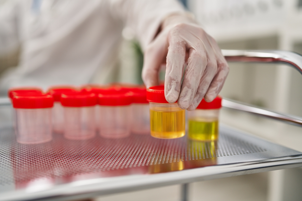 yaz, tatil, sağlık, kontrol, test