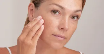 Güneş Lekelerine Karşı Neler Yapabilirsin?