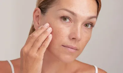 Güneş Lekelerine Karşı Neler Yapabilirsin?