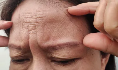 Yüz Kırışıklığına İyi Gelen Ürünler