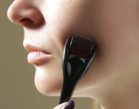 Dermoroller Nedir, Ne İşe Yarar?