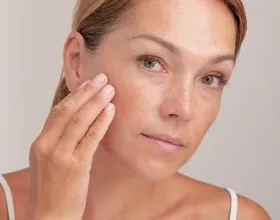 Güneş Lekelerine Karşı Neler Yapabilirsin?