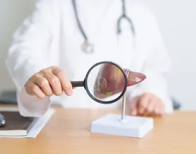 Hepatite Karşı Karaciğerini Kuvvetlendiren Besinler